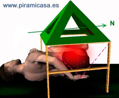 Tratamiento antipiramidal caderas