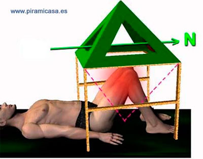Tratamiento antipiramidal rodillas