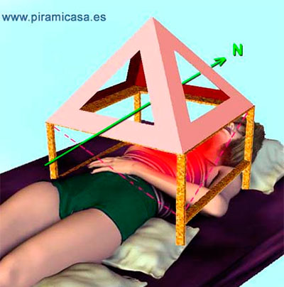 Tratamiento antipiramidal torso