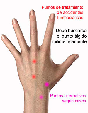 Puntos tratamiento Su-jok