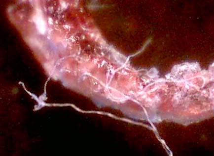 Otra fibra relacionada con morgellons